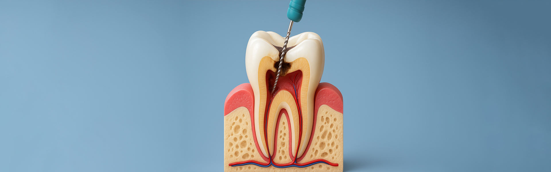 How Root Canal Therapy Restores Smiles in Bayou Vista, TX